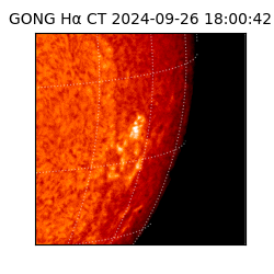 gong - 2024-09-26T18:00:42