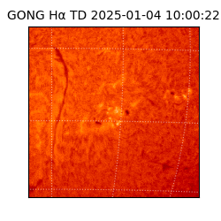 gong - 2025-01-04T10:00:22