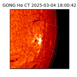 gong - 2025-03-04T18:00:42
