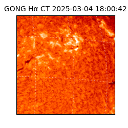 gong - 2025-03-04T18:00:42