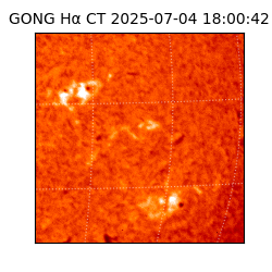 gong - 2025-07-04T18:00:42