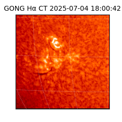 gong - 2025-07-04T18:00:42