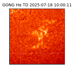 gong - 2025-07-18T10:00:11