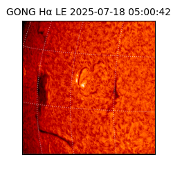 gong - 2025-07-18T05:00:42