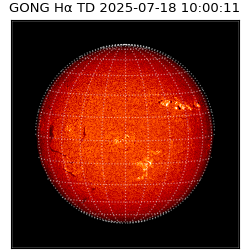 gong - 2025-07-18T10:00:11