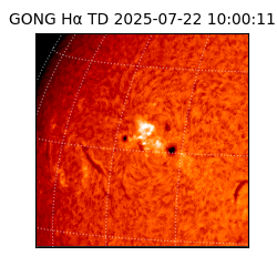 gong - 2025-07-22T10:00:11