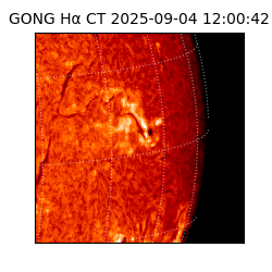 gong - 2025-09-04T12:00:42