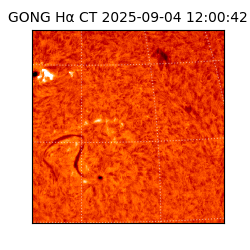 gong - 2025-09-04T12:00:42