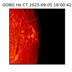 gong - 2025-09-05T18:00:42