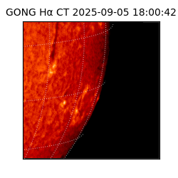 gong - 2025-09-05T18:00:42