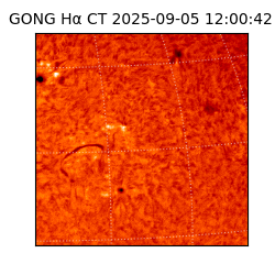 gong - 2025-09-05T12:00:42