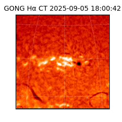 gong - 2025-09-05T18:00:42