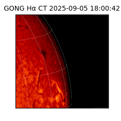 gong - 2025-09-05T18:00:42