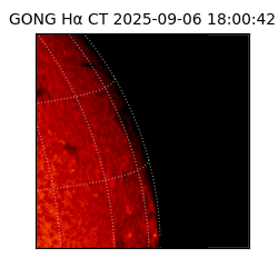 gong - 2025-09-06T18:00:42