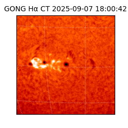 gong - 2025-09-07T18:00:42