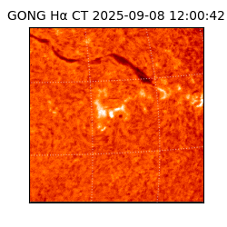 gong - 2025-09-08T12:00:42