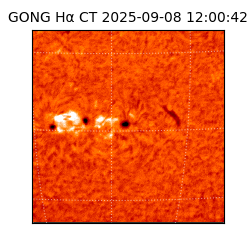 gong - 2025-09-08T12:00:42