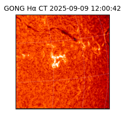 gong - 2025-09-09T12:00:42