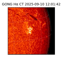 gong - 2025-09-10T12:01:42