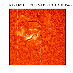 gong - 2025-09-18T17:00:42