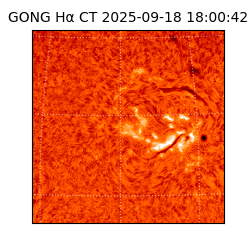 gong - 2025-09-18T18:00:42