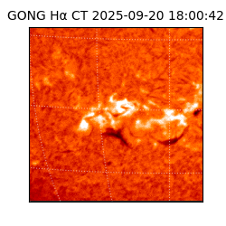 gong - 2025-09-20T18:00:42