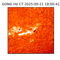 gong - 2025-09-21T18:00:42