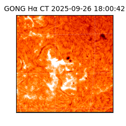 gong - 2025-09-26T18:00:42