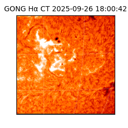 gong - 2025-09-26T18:00:42