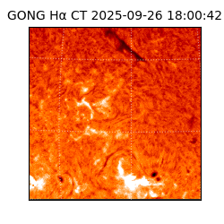 gong - 2025-09-26T18:00:42