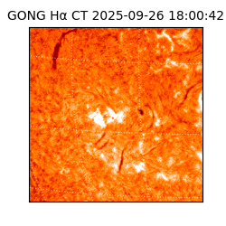 gong - 2025-09-26T18:00:42