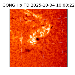 gong - 2025-10-04T10:00:22