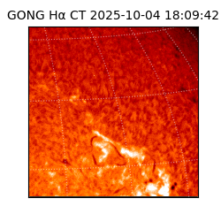 gong - 2025-10-04T18:09:42