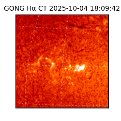 gong - 2025-10-04T18:09:42