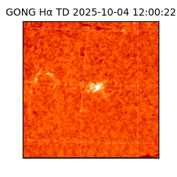 gong - 2025-10-04T12:00:22