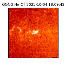 gong - 2025-10-04T18:09:42
