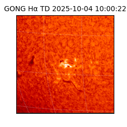 gong - 2025-10-04T10:00:22