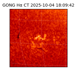 gong - 2025-10-04T18:09:42