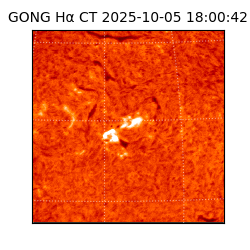 gong - 2025-10-05T18:00:42