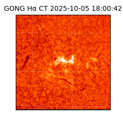 gong - 2025-10-05T18:00:42