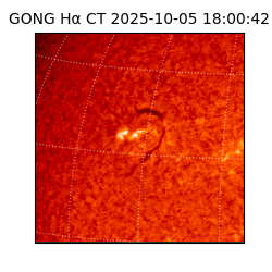 gong - 2025-10-05T18:00:42
