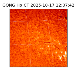 gong - 2025-10-17T12:07:42