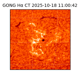gong - 2025-10-18T11:00:42