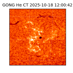 gong - 2025-10-18T12:00:42