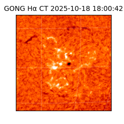 gong - 2025-10-18T18:00:42