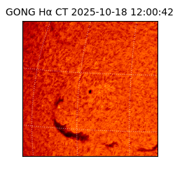 gong - 2025-10-18T12:00:42