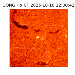 gong - 2025-10-18T12:00:42