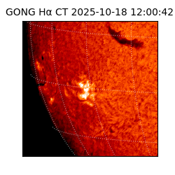 gong - 2025-10-18T12:00:42