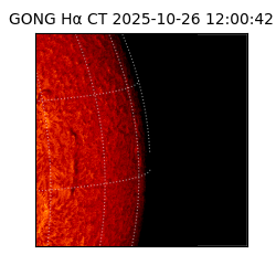 gong - 2025-10-26T12:00:42