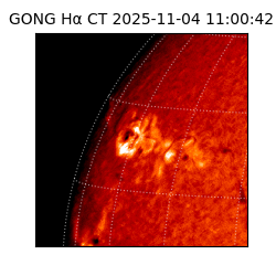 gong - 2025-11-04T11:00:42